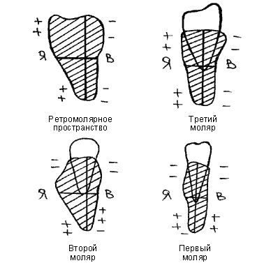 Особенности функциональных деформаций нижней челюсти