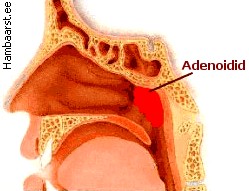 adenoid