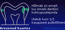 Arenenud interproksimaalne kaaries