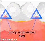 floss2.gif (12383 bytes)