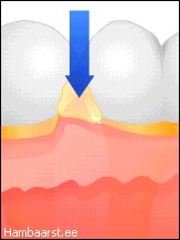 floss4.jpg (7085 bytes)