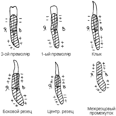 Особенности функциональных деформаций нижней челюсти