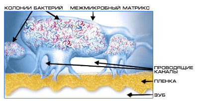 Биопленка: новый взгляд на бляшку