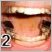 Kui hambakape ei aita ... ehk Bruksismi ravi ebatraditsiooniliste vahenditega - 2.osa