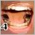 Kui hambakape ei aita ... ehk Bruksismi ravi ebatraditsiooniliste vahenditega - 4.osa