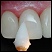 Direct esthetic restoration - esthetic sense stopped in reality