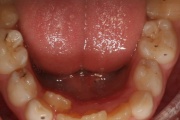 pilt