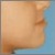 pilt