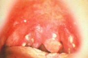 pilt
