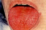 pilt