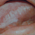 pilt