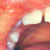 pilt