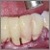 pilt