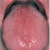 pilt