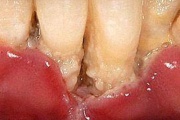 pilt