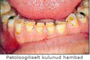 pilt