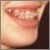 pilt