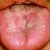 pilt pilt