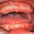 pilt