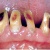 pilt