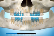 pilt