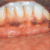 pilt