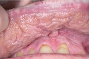 pilt pilt