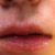 pilt
