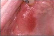 pilt