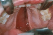 pilt