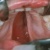 pilt