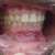 pilt