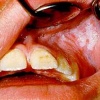 pilt