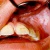 pilt