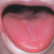 pilt