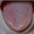 pilt