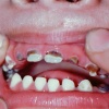 pilt