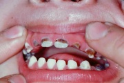 pilt