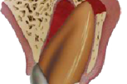 pilt