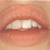 pilt