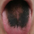 pilt
