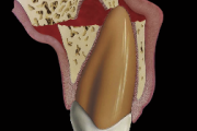 pilt
