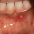 pilt