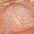 pilt