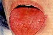 pilt