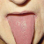 pilt