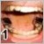 pilt