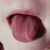 pilt