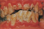 pilt