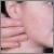 pilt
